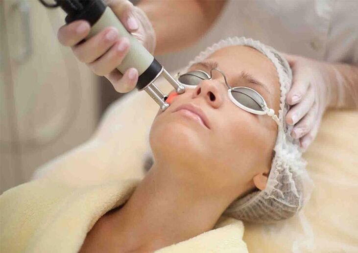 Procedura cu laser de întinerire a pielii din jurul ochilor